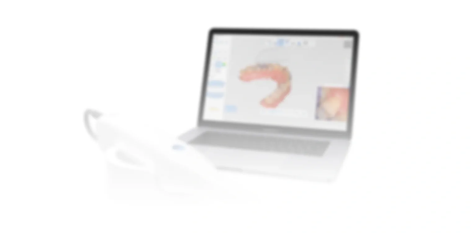 SHINING 3D intraoral scanner and laptop